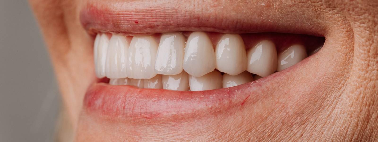 Dental Implants 1 Dental Implants in Normal, IL_ Restore Your Smile Permanently