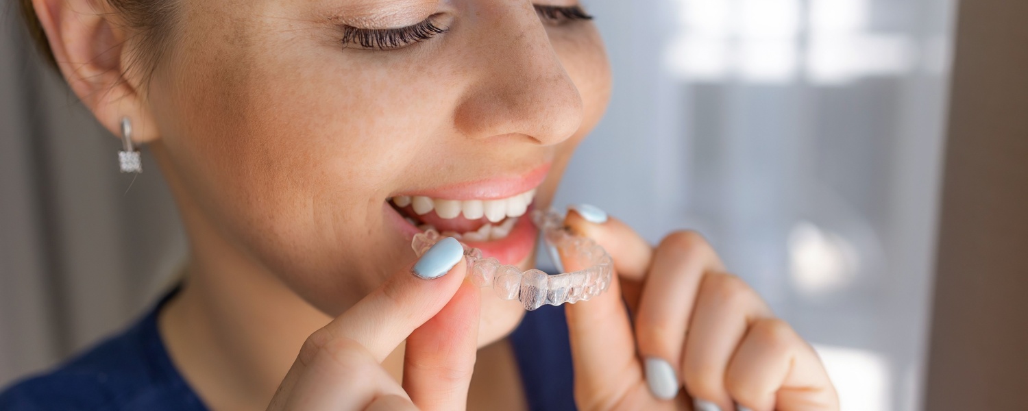 Invisalign in Bloomington, IL