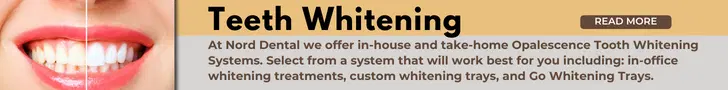 Teeth Whitening in Bloomington, IL