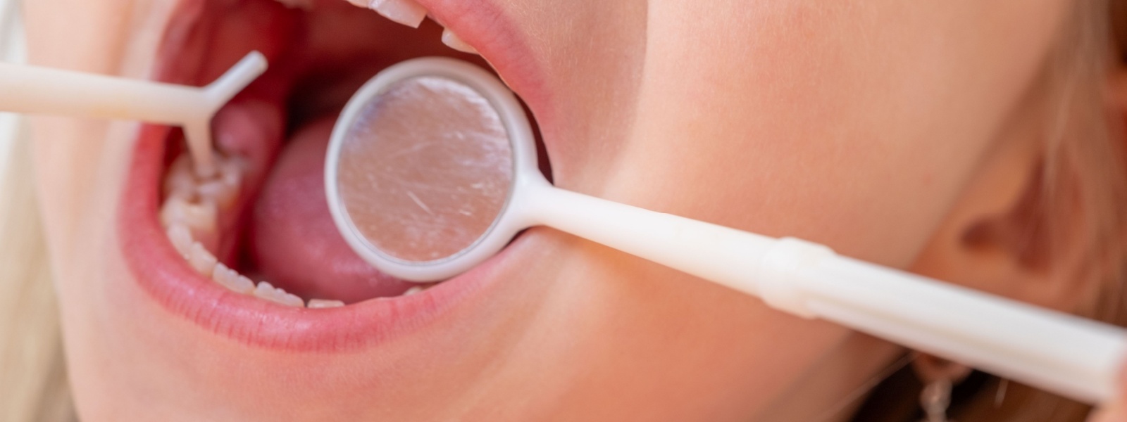Preventive Dentistry in Normal, IL: Keeping Smiles Healthy