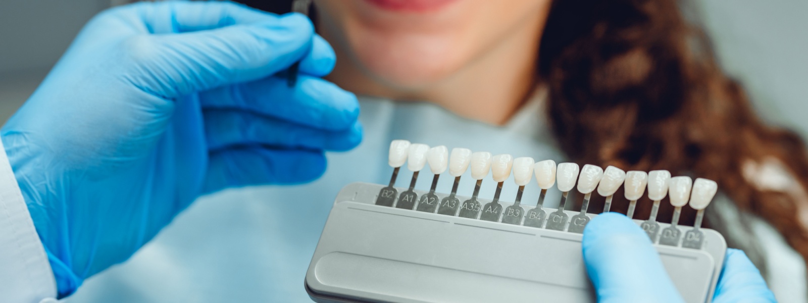 Tooth-Colored Fillings in Normal, IL: Invisible Repairs